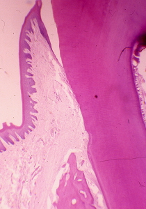 歯周組織の顕微鏡写真
